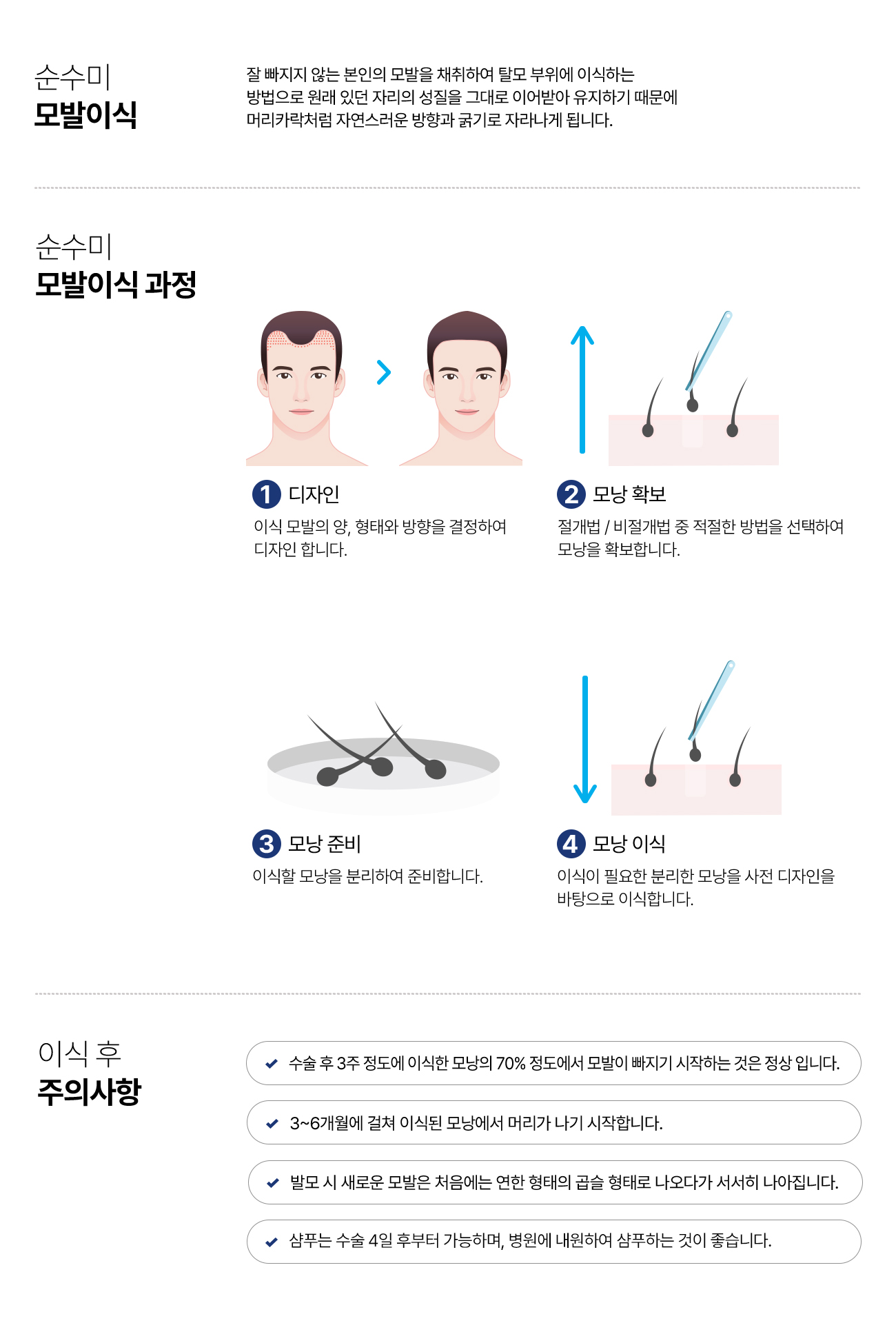 모발이식